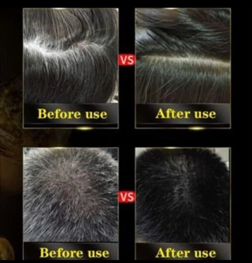 HERBAL HAIR DYE UNISEX SHAMPOO 3 IN 1 (BUY 1 GET 1 FREE)- BLOSDREAM